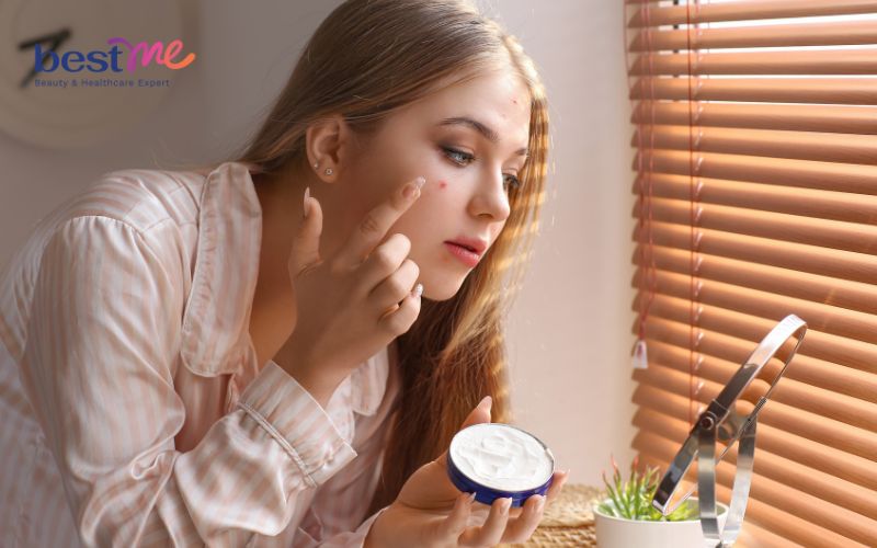 nguyen-nhan-bi-mun-viem-do-o-ma-va-cach-dieu-tri-hieu-qua-5 Nguyên nhân bị mụn viêm đỏ ở má và cách điều trị hiệu quả - 5