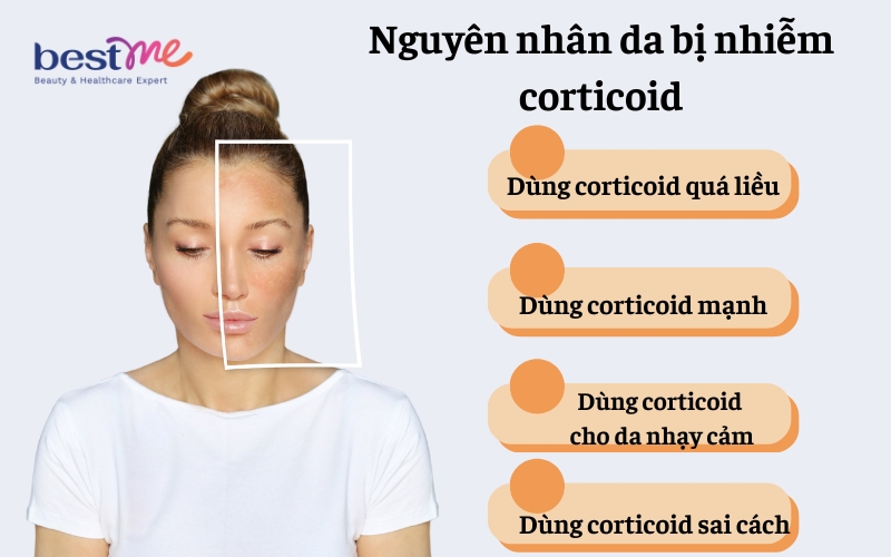 Nguyên nhân khiến da bị nhiễm corticoid