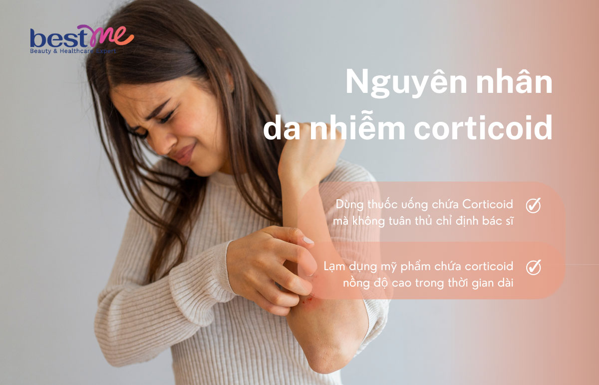 Nguyên nhân chủ yếu khiến da nhiễm corticoid
