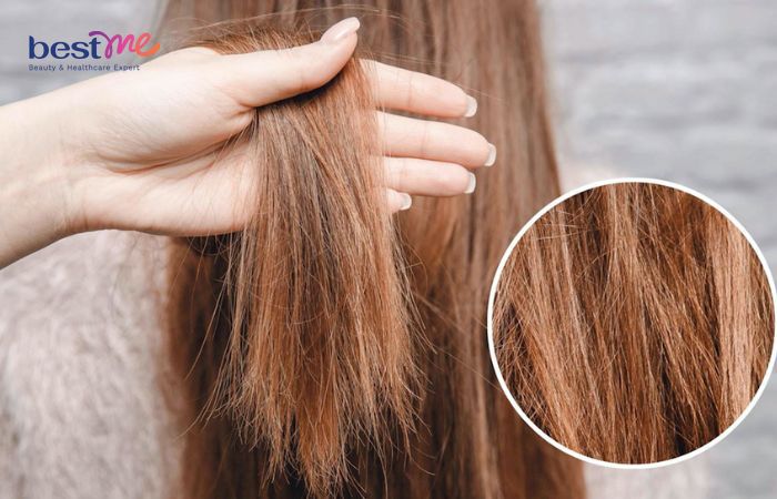 Có rất nhiều nguyên nhân khiến tóc bị khô xơ