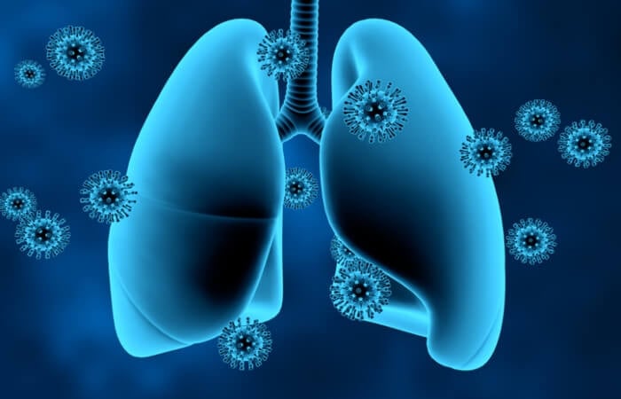 Xơ phổi hậu covid nếu không được can thiệp sớm có thể kéo dài nhiều năm, thậm chí vĩnh viễn