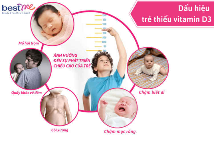 nhung-dieu-cha-me-can-luu-y-khi-bo-sung-vitamin-d-cho-tre-so-sinh--2 Những điều cha mẹ cần lưu ý khi bổ sung vitamin D cho trẻ sơ sinh - 2