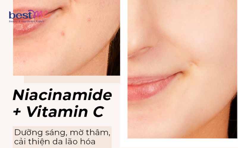 Niacinamide kết hợp với gì hiệu quả? 10 thành phần tốt nhất - 6