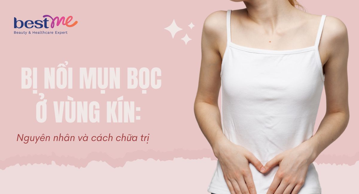 Nguyên nhân bị nổi mụn bọc ở vùng kín và cách chữa trị