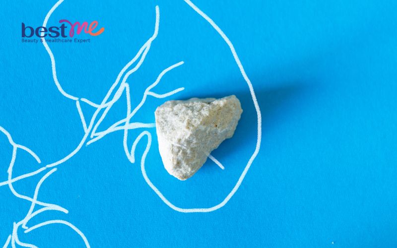 nuoc-dua-bao-nhieu-calo-bi-quyet-giam-can-va-duy-tri-suc-khoe-voi-nuoc-dua-4 Nước dừa bao nhiêu calo? Bí quyết giảm cân và duy trì sức khỏe với nước dừa - 4