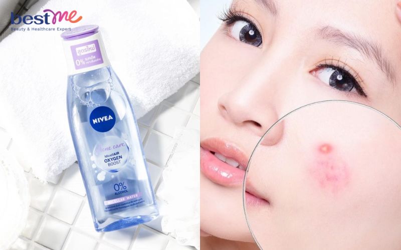 nuoc-tay-trang-nivea-co-may-loai-nuoc-tay-trang-nivea-co-con-khong-2 Nước tẩy trang Nivea có mấy loại? Nước tẩy trang Nivea có cồn không? - 2