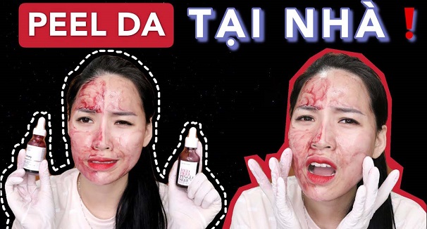 Kem chống nắng nào phù hợp cho da dầu mụn và có khả năng kiểm soát dầu?
