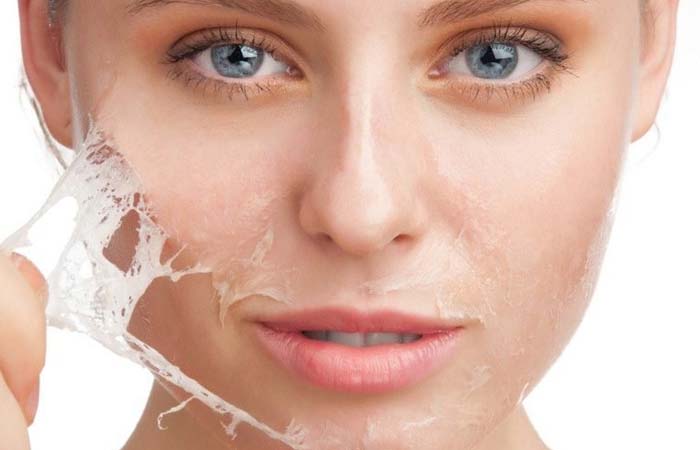 Sau quá trình peel giúp giúp làn của bạn da trở nên sáng, mịn màng và tươi trẻ hơn