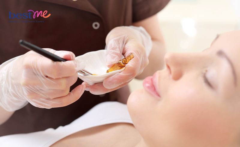 Việc peel da có thể gặp những tác dụng phụ tùy vào mức độ, đặc biệt là những người có làn da nhạy cảm