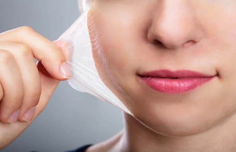 Dưỡng ẩm, phục hồi da đầy đủ sẽ giúp da đẹp lên nhanh sau khi peel