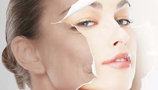 Peel da là giải pháp hoàn hảo giải quyết những vấn đề như mụn, thâm nám