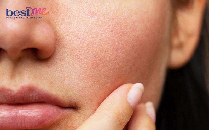 Đối với làn da bị lão hóa trang điểm có thể trở nên khó khăn