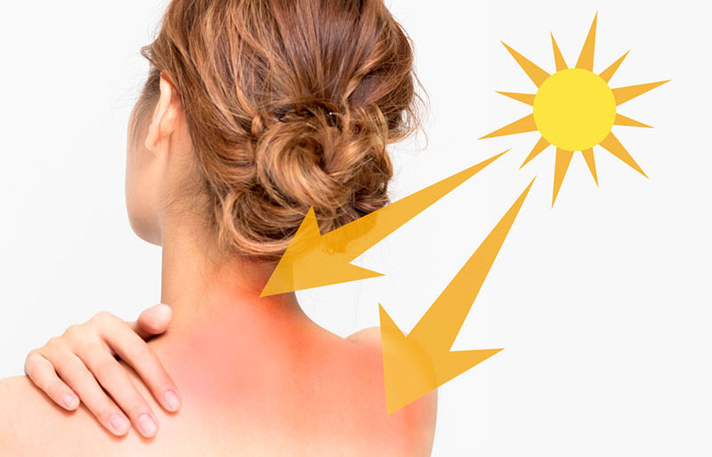 Các lưu ý giúp tóc nàng không bị cháy mùa nắng nóng #30 Các lưu ý giúp tóc nàng không bị cháy mùa nắng nóng