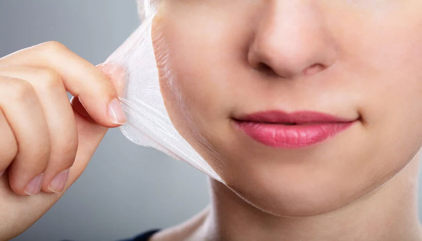 Công dụng của peel da 