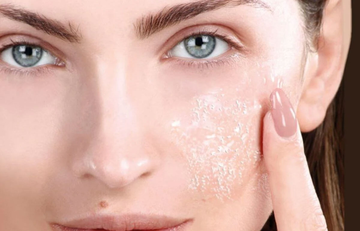 Peel da là việc sử dụng các hợp chất hóa học để tác động lên bề mặt da