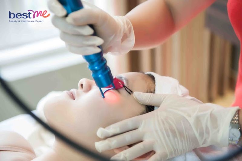 Điều trị da bằng laser là phương pháp sử dụng chùm tia laser để để kích thích tái tạo tế bào da