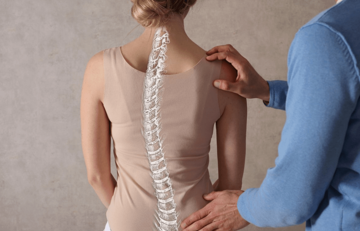 Tập plank sai tư thế có thể khiến bạn đau lưng, vẹo cột sống