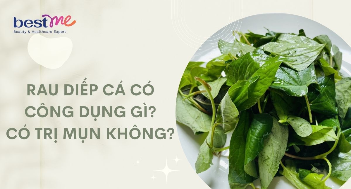 Rau diếp cá có công dụng gì? Có trị mụn không?