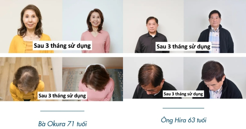 review-xit-moc-toc-nhat-ban-newmo-kich-thich-moc-toc-6 Review xịt mọc tóc Nhật Bản NEWMO kích thích mọc tóc - 6