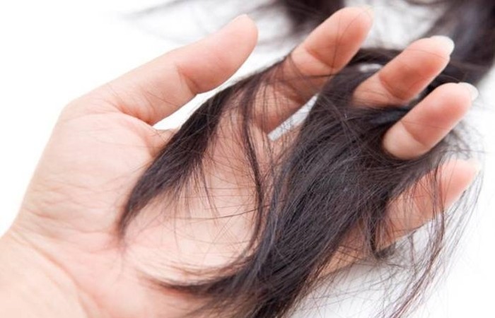 Ảnh hưởng tâm lý sau khi sinh khiến chị em bị rụng tóc nhiều