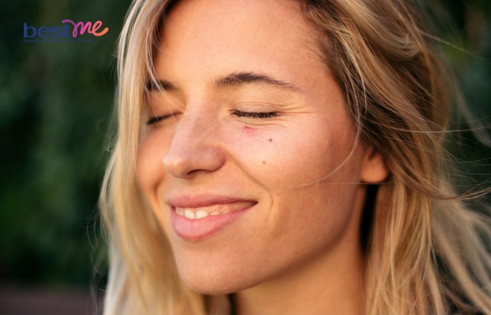 Việc dưỡng ẩm giúp tăng cường hàng rào bảo vệ da