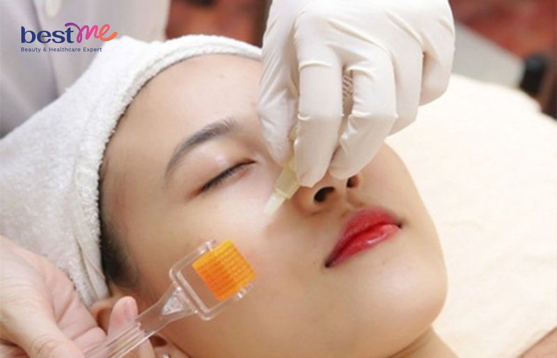 Lăn kim là gì? Có tác dụng như thế nào?