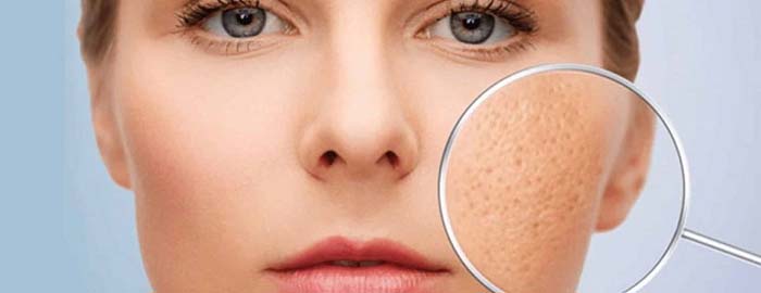 Ceramide giúp se khít lỗ chân lông