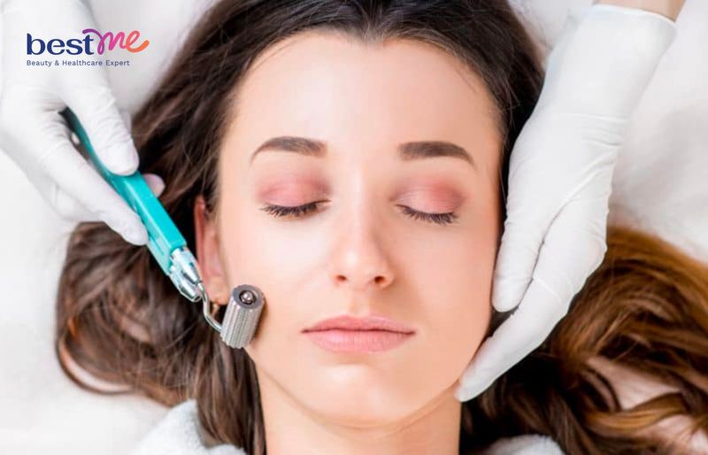 Thủ thuật lăn kim nhằm kích thích tăng sinh collagen.