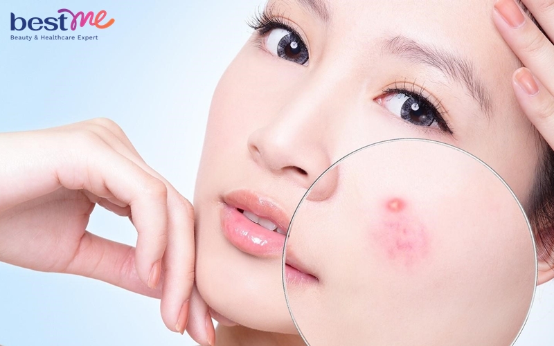 serum-vitamin-c-dung-sang-hay-toi-cach-bao-quan-serum-vitamin-c-5 Serum vitamin C dùng sáng hay tối? Cách bảo quản serum vitamin C - 5