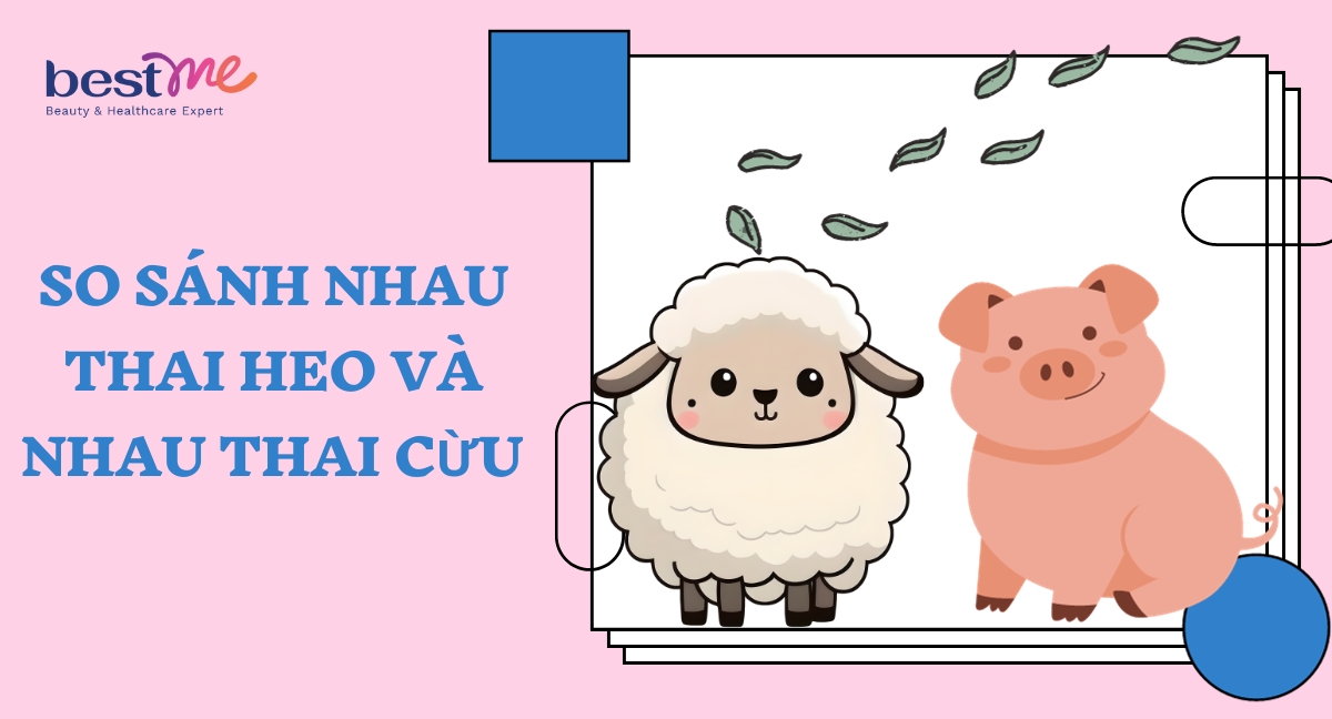 Lựa chọn loại nhau thai phù hợp với bản thân