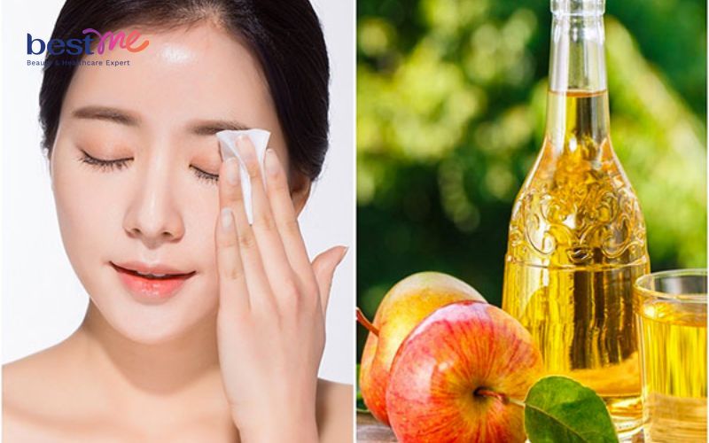 Da mặt ửng đỏ 2 bên má là dấu hiệu của bệnh gì? - 6