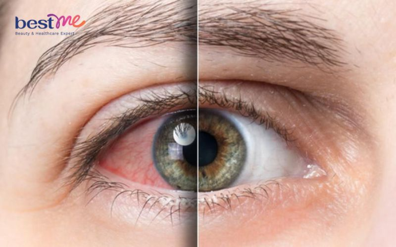 sua-ong-chua-la-gi-co-nen-uong-sua-ong-chua-thuong-xuyen-4 Sữa ong chúa là gì? Có nên uống sữa ong chúa thường xuyên? - 4