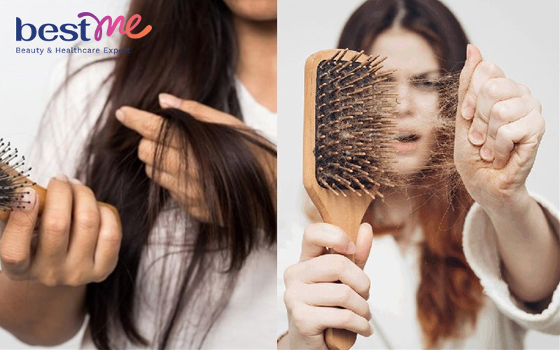 Vitamin B1 giúp giảm stress & giảm tóc rụng