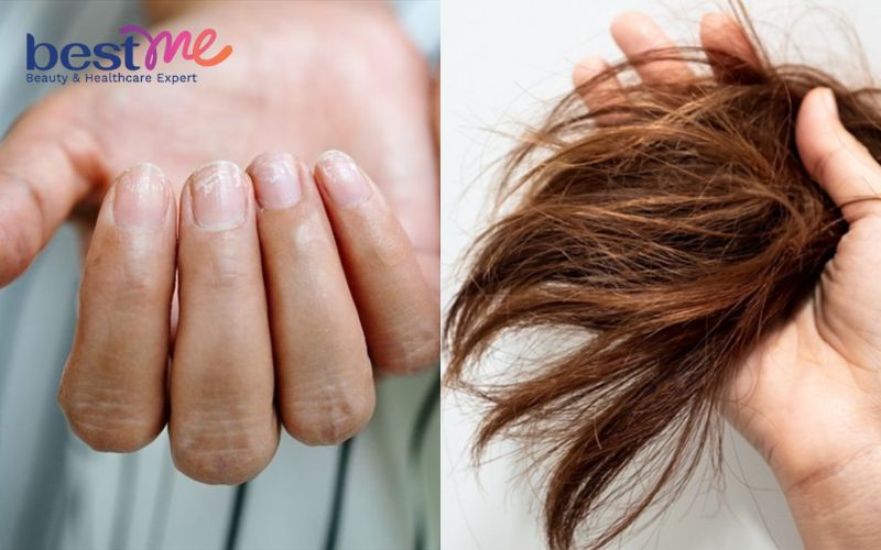 Dấu hiệu trên tóc, da và móng tay