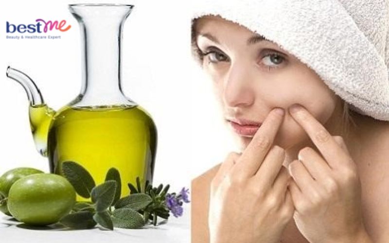 Dầu Oliu gây mụn