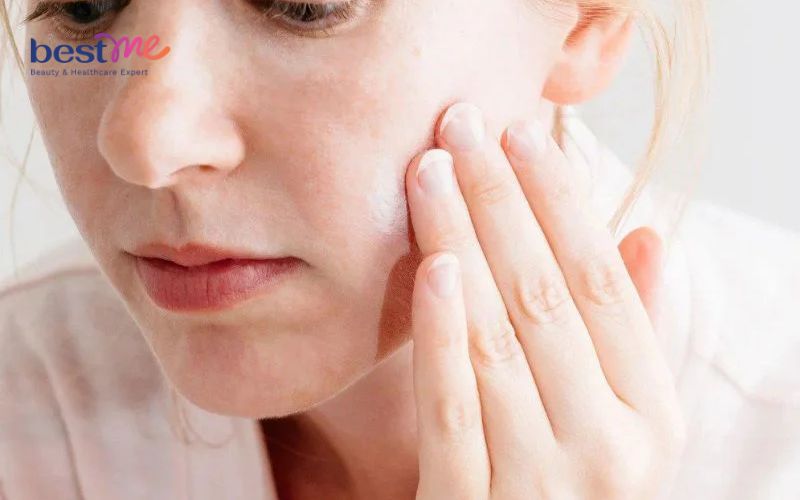 Tại sao bôi kem chống nắng bị vón cục? Hướng dẫn cách bôi đúng - 7