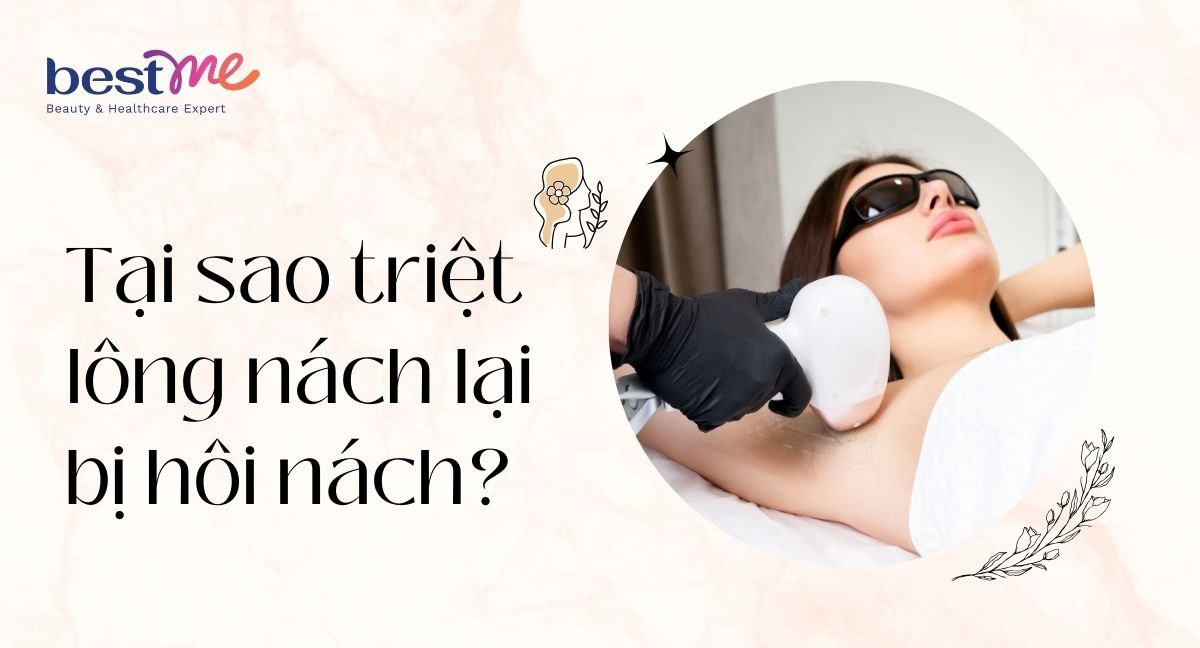 Tại sao triệt lông nách lại bị hôi nách? 4 nguyên nhân bất ngờ