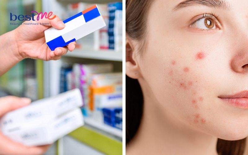 tai-sao-uong-thuoc-giai-doc-gan-bi-noi-mun-lam-gi-de-het-2 Tại sao uống thuốc giải độc gan bị nổi mụn? Làm gì để hết? - 2