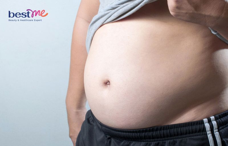 Tình trạng béo bụng ở nam giới
