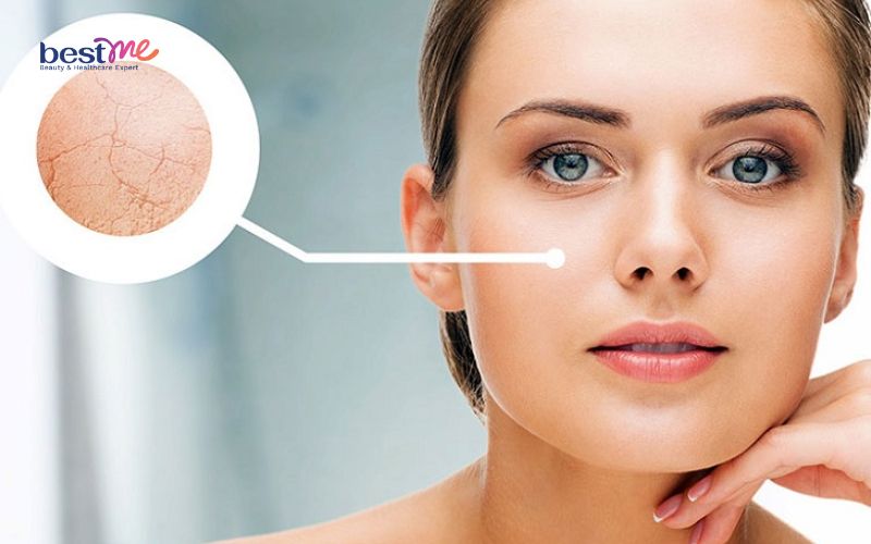 Thiếu ẩm khiến da bị xỉn màu