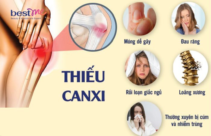 Dấu hiệu thiếu canxi ở mẹ sau sinh 