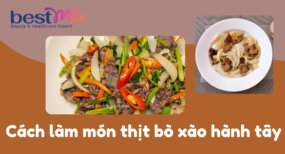 Bí quyết làm món thịt bò xào hành tây thơm ngon khó cưỡng 