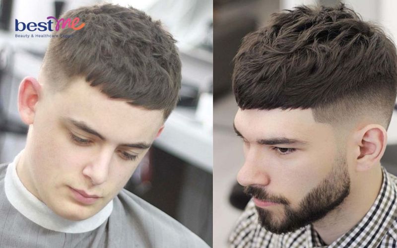 Kiểu tóc undercut mái ngố