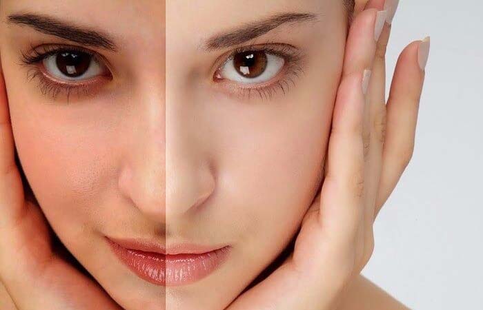 Làm sáng đều màu da