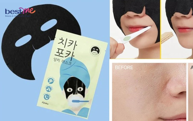 Top 10+ mặt nạ thải độc da tốt nhất hiện nay bạn nên mua - 9