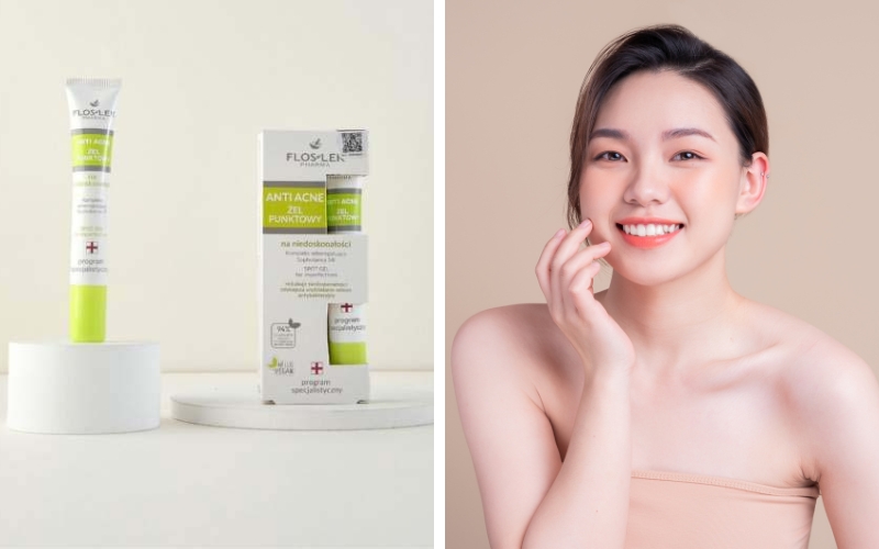 top-11-san-pham-kem-tri-mun-cho-da-dau-tot-an-toan-nhat-8 TOP 11 sản phẩm kem trị mụn cho da dầu tốt an toàn nhất - 8