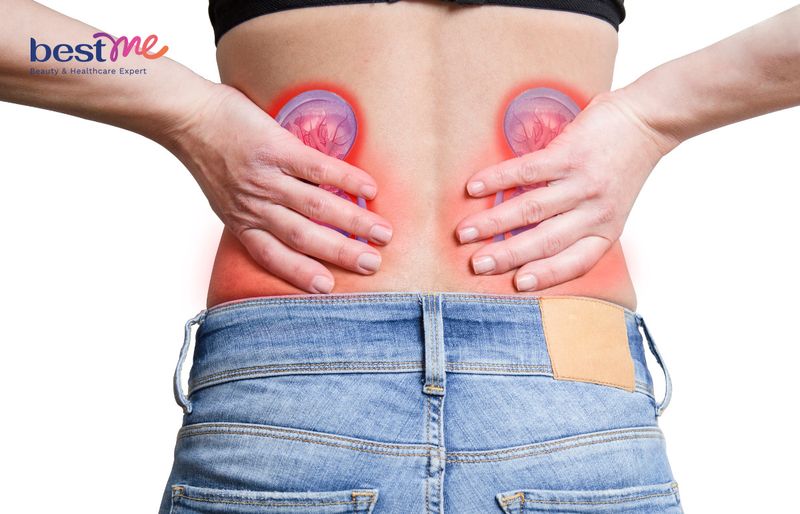 Cây râu mèo có tác dụng lợi tiểu trị sỏi thận