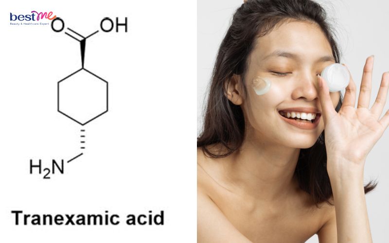 Tranexamic Acid kết hợp với gì? 10 thành phần kết hợp tốt nhất - 1