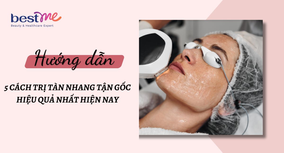 5 cách trị tàn nhang tận gốc hiệu quả nhất hiện nay