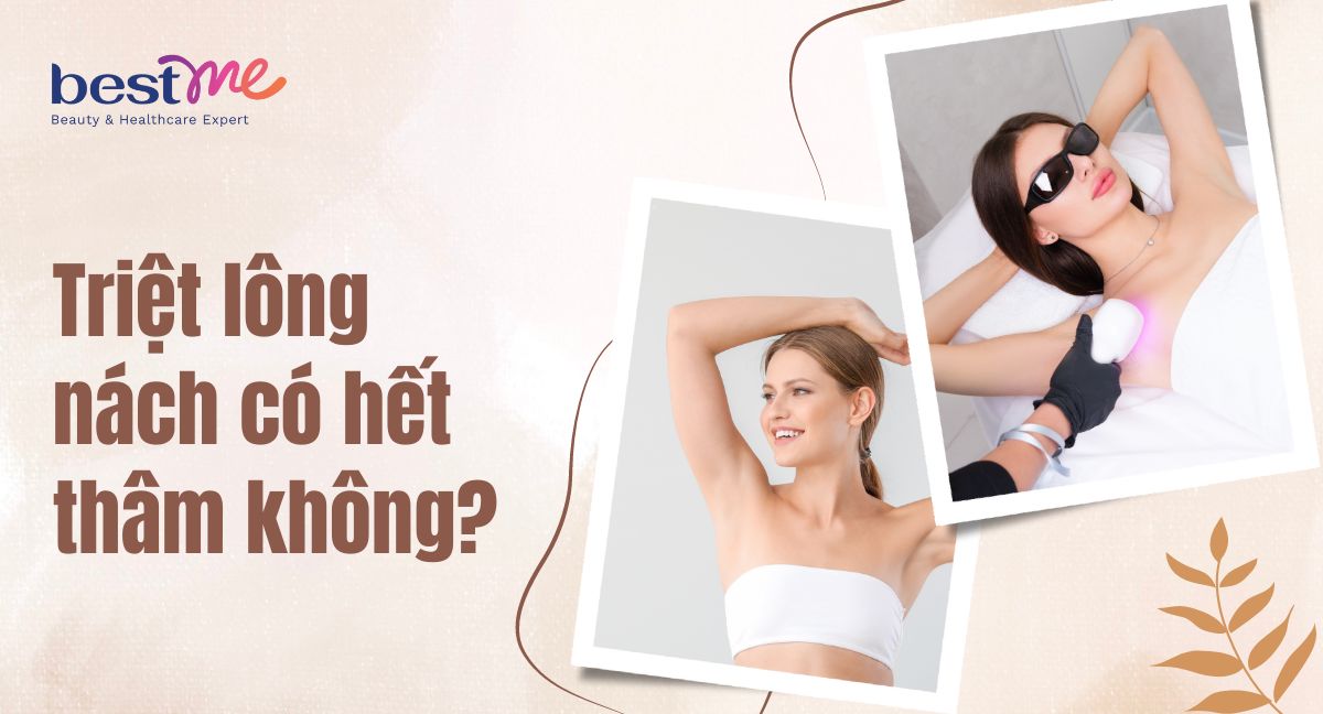 Triệt lông nách có hết thâm không? Bật mí thông tin cần biết